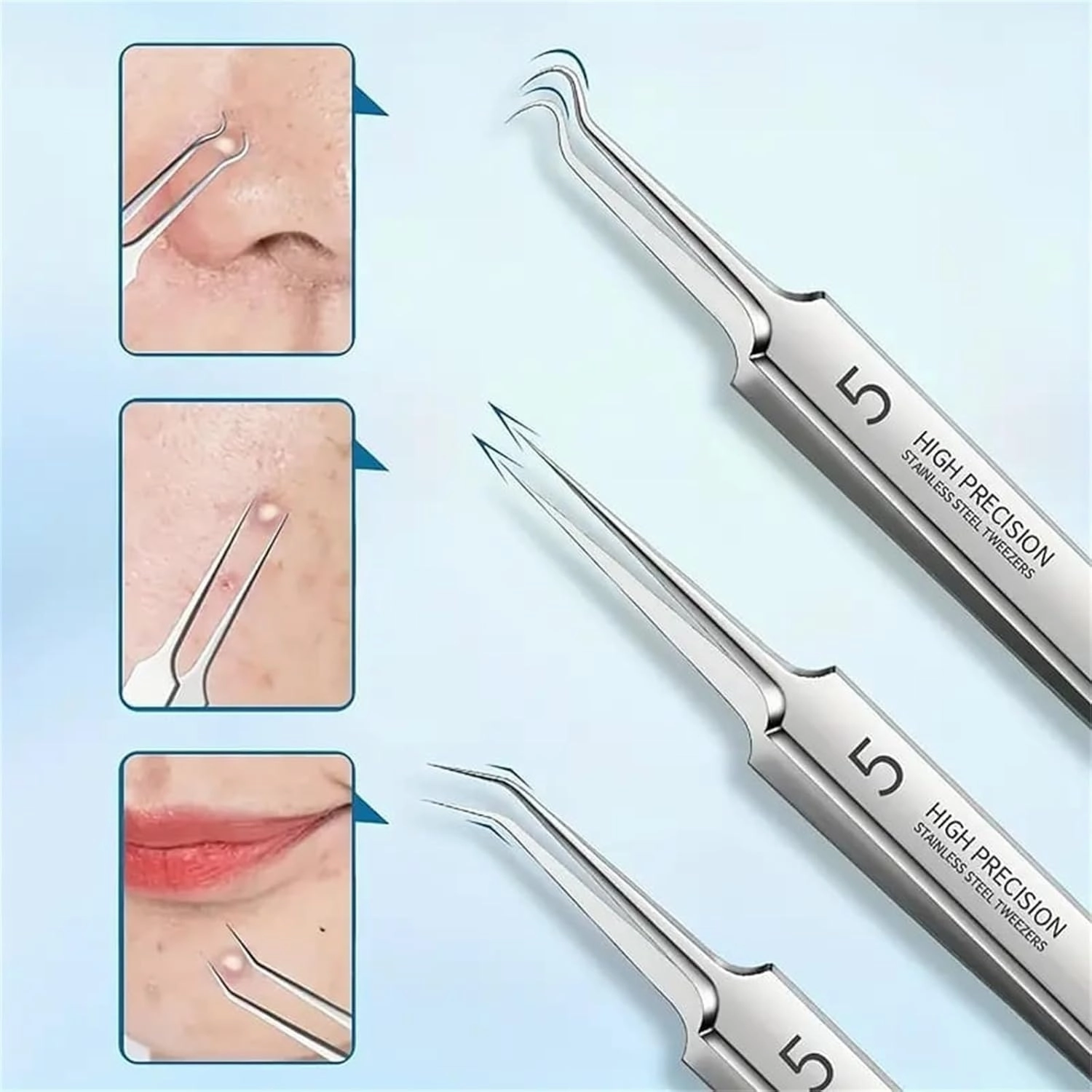 Acssart, Acssart Tweezers, Acssart Blackhead, Acssart Blackhead Remover, Acssart Stainless Steel Blackhead Remover, Stainless Steel Blackhead & Extractor Set, Gentle and Easy to Clean (8Pcs)
