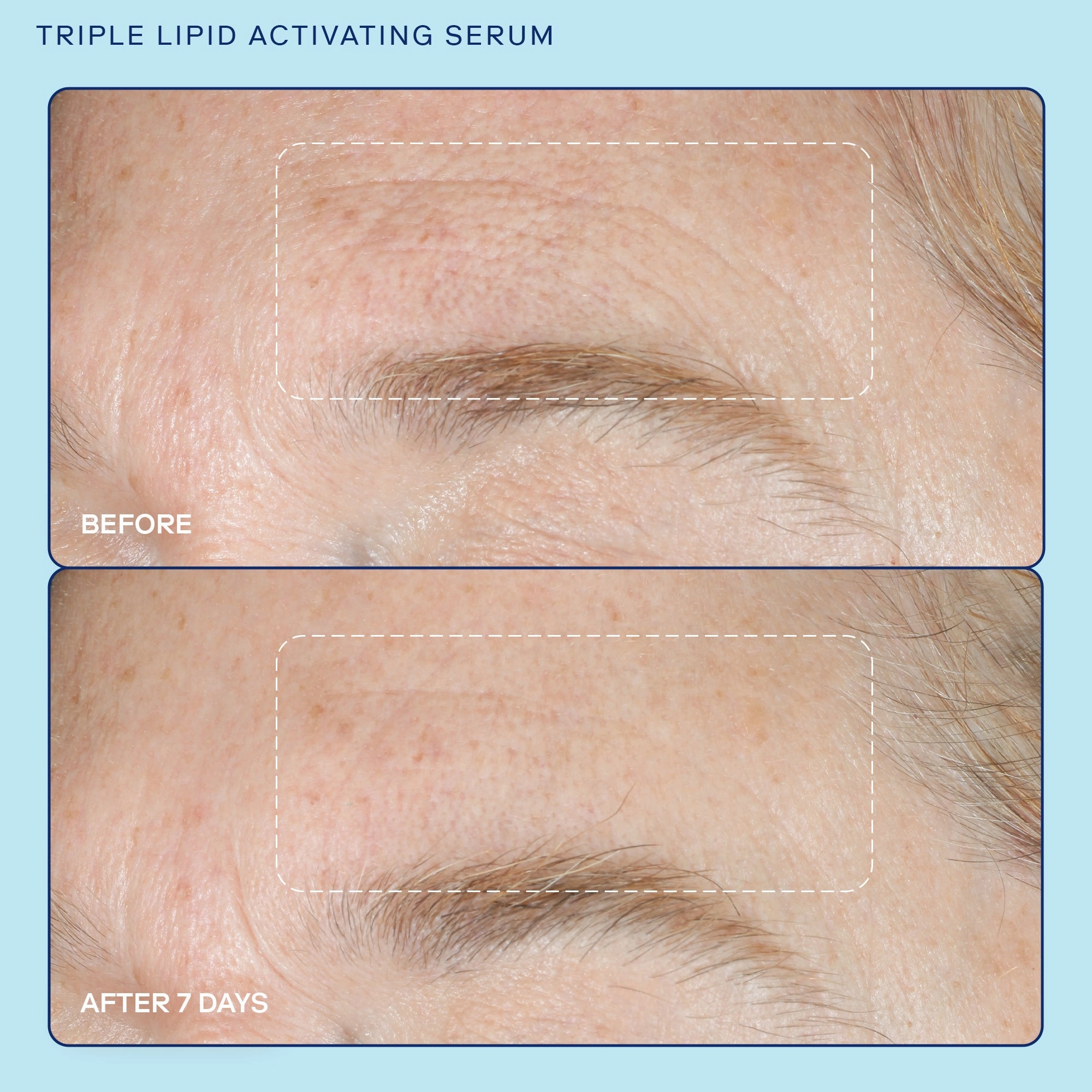 Barrier  Triple Lipid Activating Serum