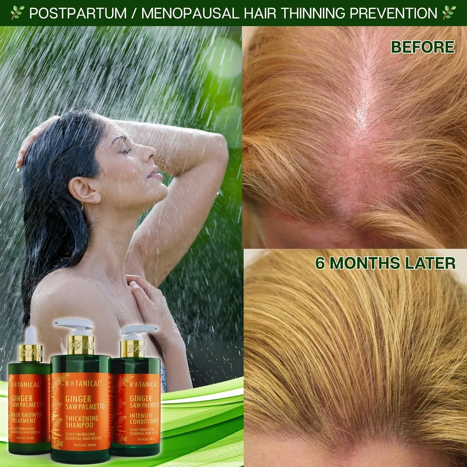 Botanical Hair Growth Ginger Shampoo with Saw Palmetto for Hair Loss and Hair Thinning Prevention Scalp Energizing Natural Thickening Shampoo Regrowth Products For Women & Men 10.2 Fl Oz