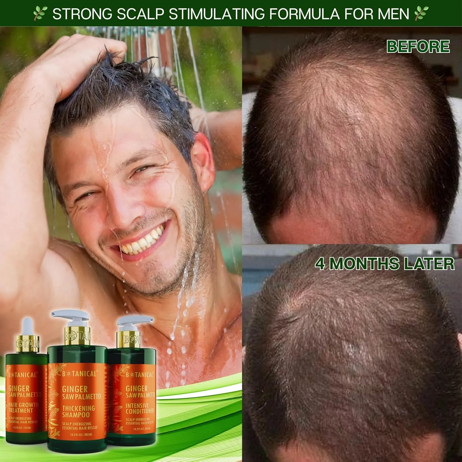 Botanical Hair Growth Ginger Shampoo with Saw Palmetto for Hair Loss and Hair Thinning Prevention Scalp Energizing Natural Thickening Shampoo Regrowth Products For Women & Men 10.2 Fl Oz