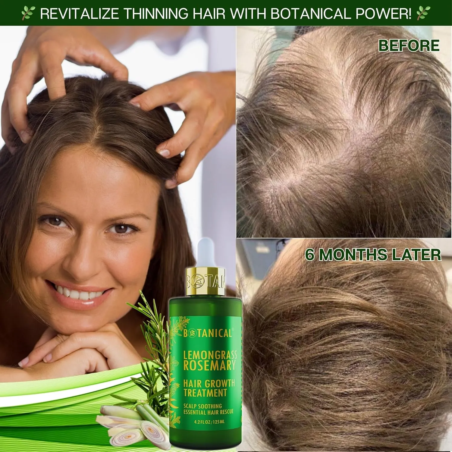 Botanical Scalp Soothing Hair Treatment with Lemongrass, Rosemary Oil, and Biotin - Stimulating Pre-Shampoo Thickening Formula for Thinning Hair in Women & Men, 4.2 Fl Oz