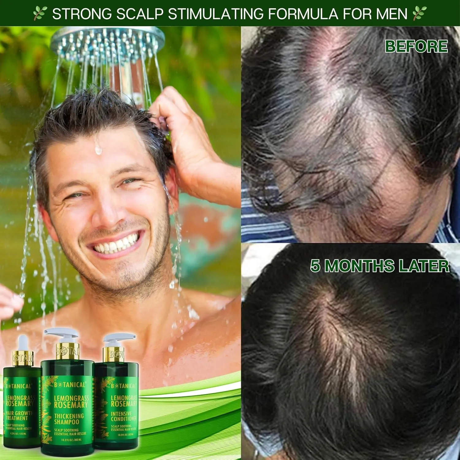 Botanical Scalp Soothing Hair Treatment with Lemongrass, Rosemary Oil, and Biotin - Stimulating Pre-Shampoo Thickening Formula for Thinning Hair in Women & Men, 4.2 Fl Oz