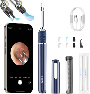 Ear Tweezers with Camera, Note5 Visual Ear Wax Removal Tool Camera with 10 Megapixel Otoscope, 3-in-1 Visual Earwax Cleaning Kit WiFi Ear Cleaning Kit, Ear Camera, Ear Otoscope Camera