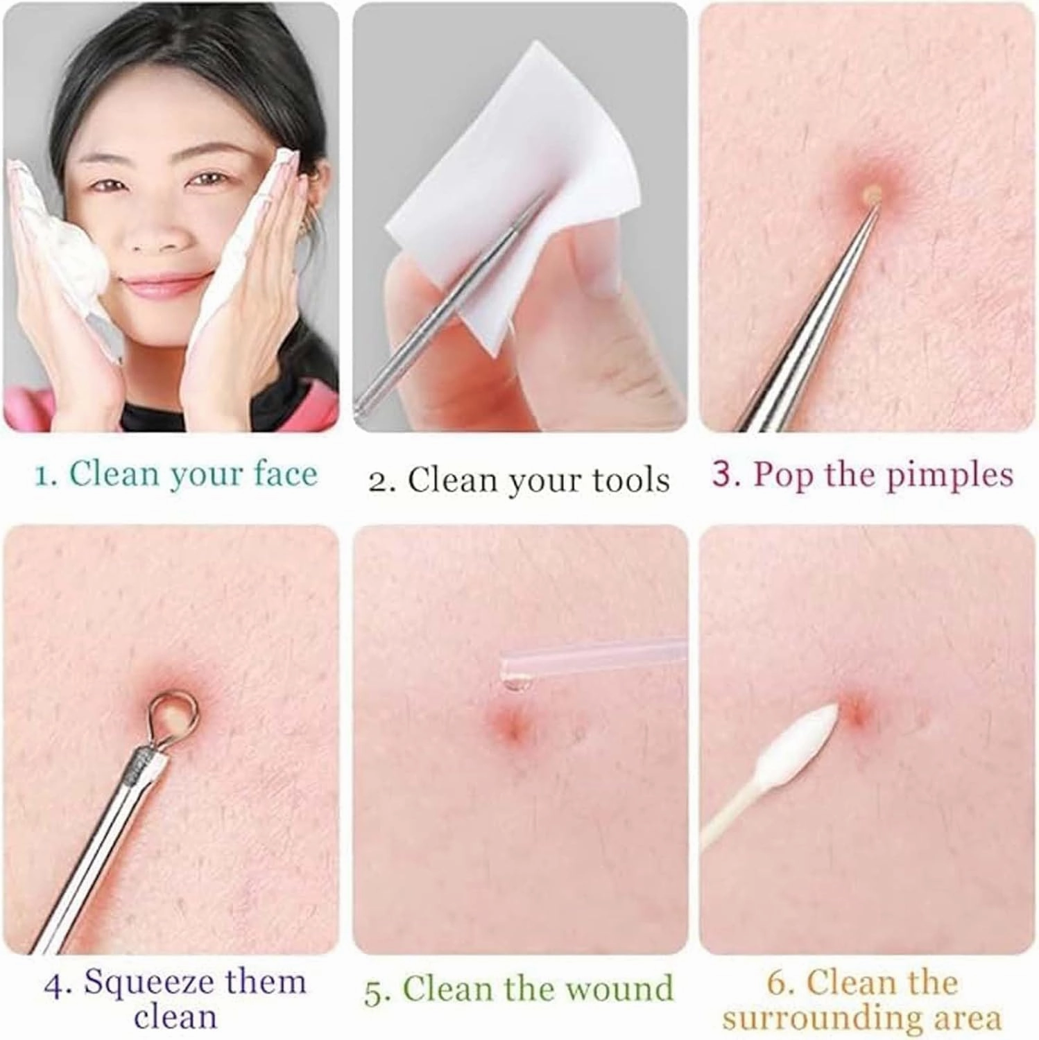 Fecong Stainless Steel Blackhead Removal Kit, Fecong Precision Tweezers, Fecong Blackhead Tweezers, Fecong, Fecong Stainless Steel Blackhead Removal Kit 3 Tweezers-B
