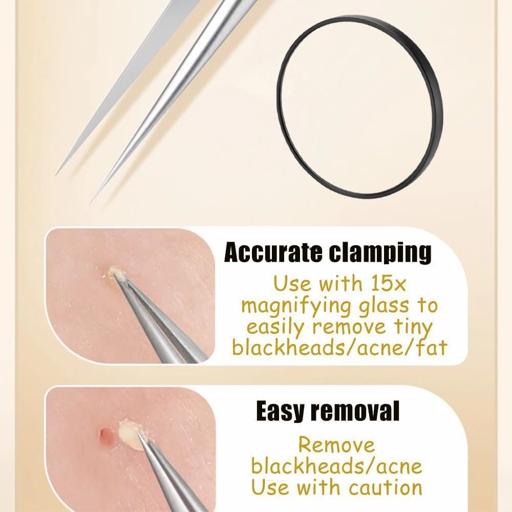 Fecong Stainless Steel Blackhead Removal Kit, Fecong Precision Tweezers, Fecong Blackhead Tweezers, Fecong, Fecong Stainless Steel Blackhead Removal Kit 3 Tweezers-B