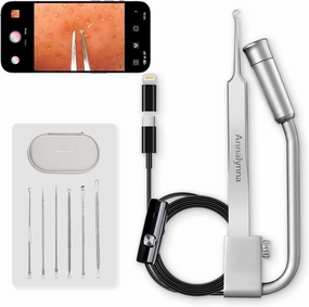 Luma 1 Visual Blackhead Remover Tweezers with Camera - Pimple Popper Tool with Camera 20x Magnification, 1080P, 8 LED Lights, with Blackhead Remover Pimple Popper Tool Kit (6 Piece Kit)