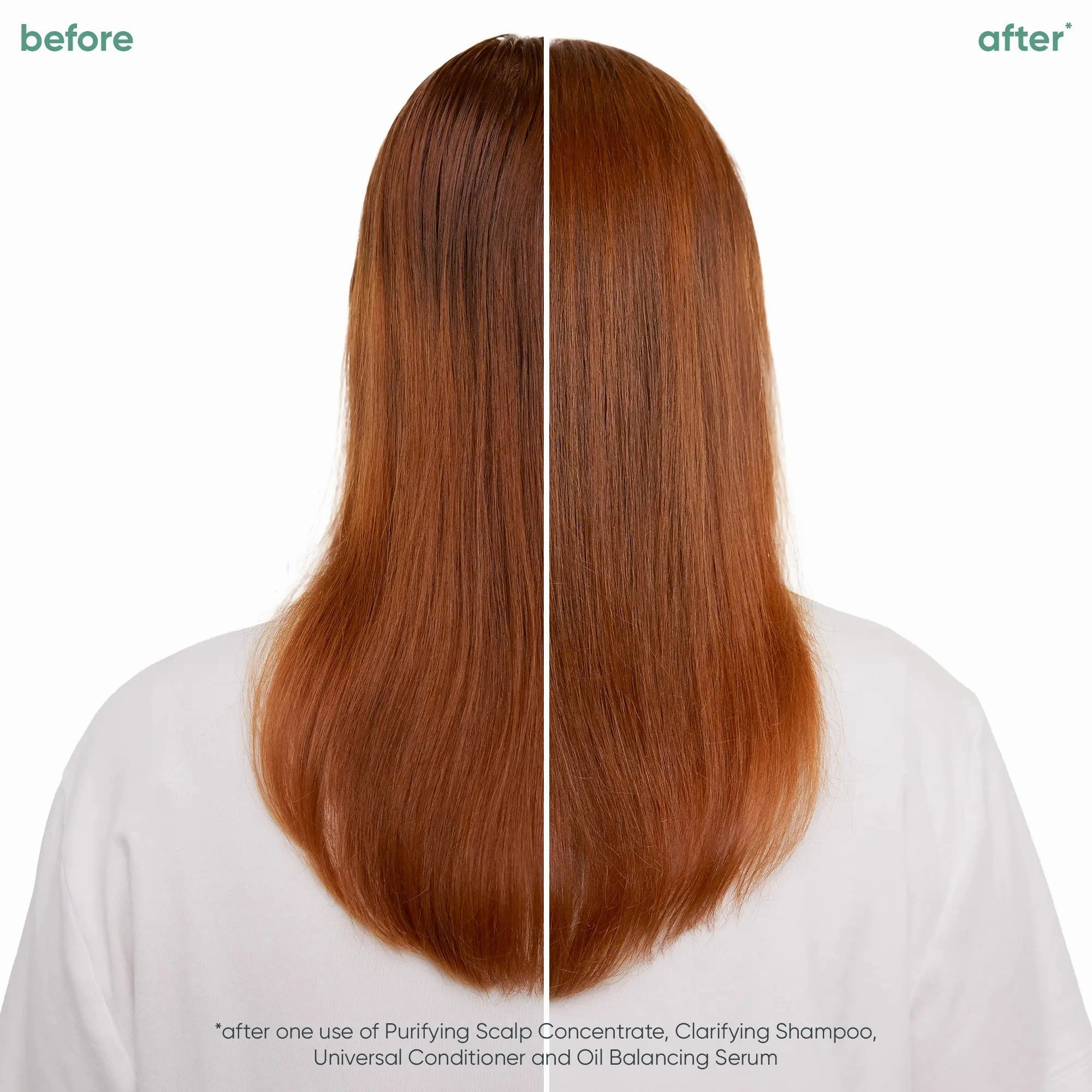 Matrix Biolage Scalp Sync Clarifying Shampoo 400ML