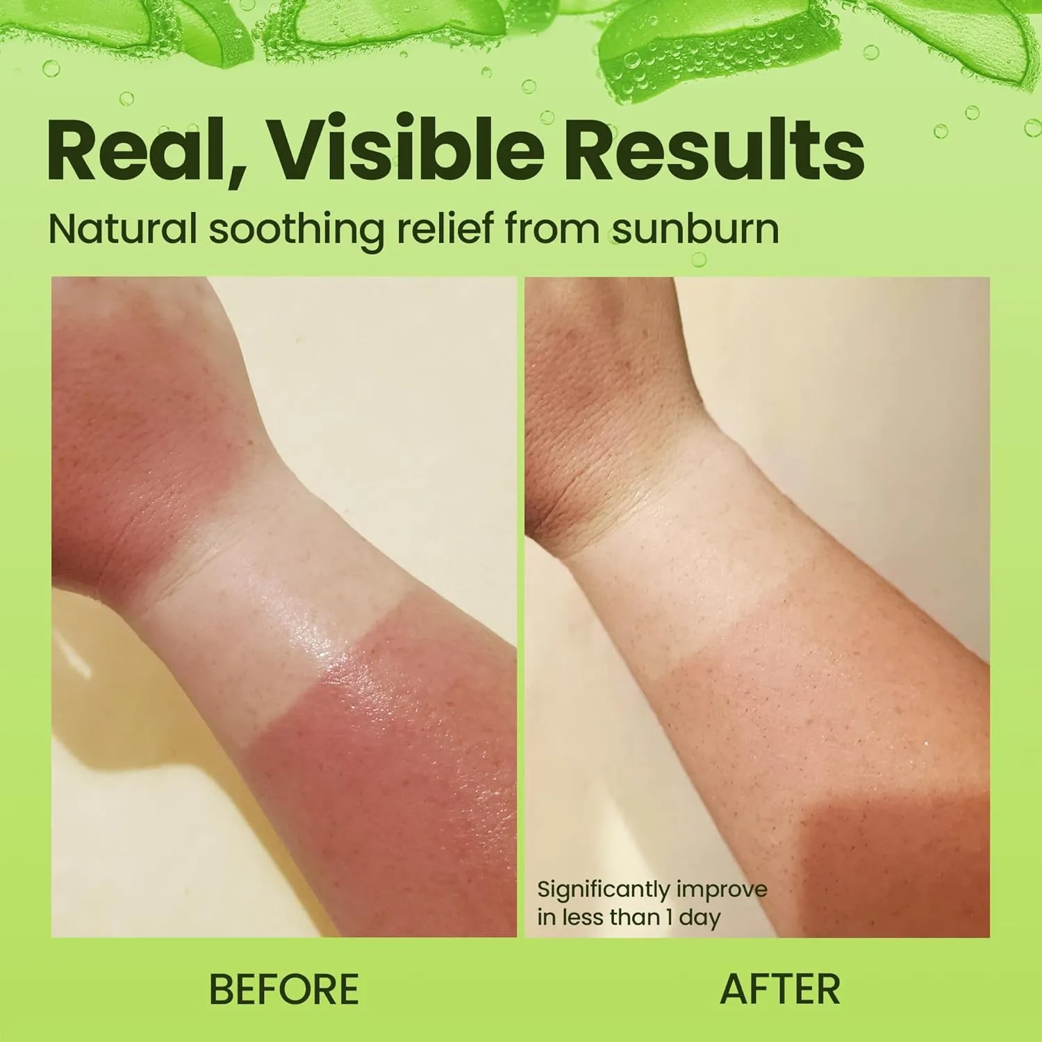 Organic Aloe Vera Gel - 100% Pure for Skin, Sunburn Relief & Face Moisturizer - Extracted from Aloe Vera Plant with Manuka Honey, Orchid & Apple Stem Cells - Everyday Use - 64 fl oz