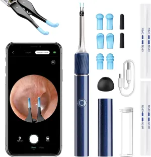 Qimic Ear Camera with Tweezers - Ear Cleaner with Camera,1080P HD Earwax Removal Tool with Light, IP67 Ear Cleaning Kit with 6 Ear Spoon, Ear Camera Otoscope for iPhone, Android