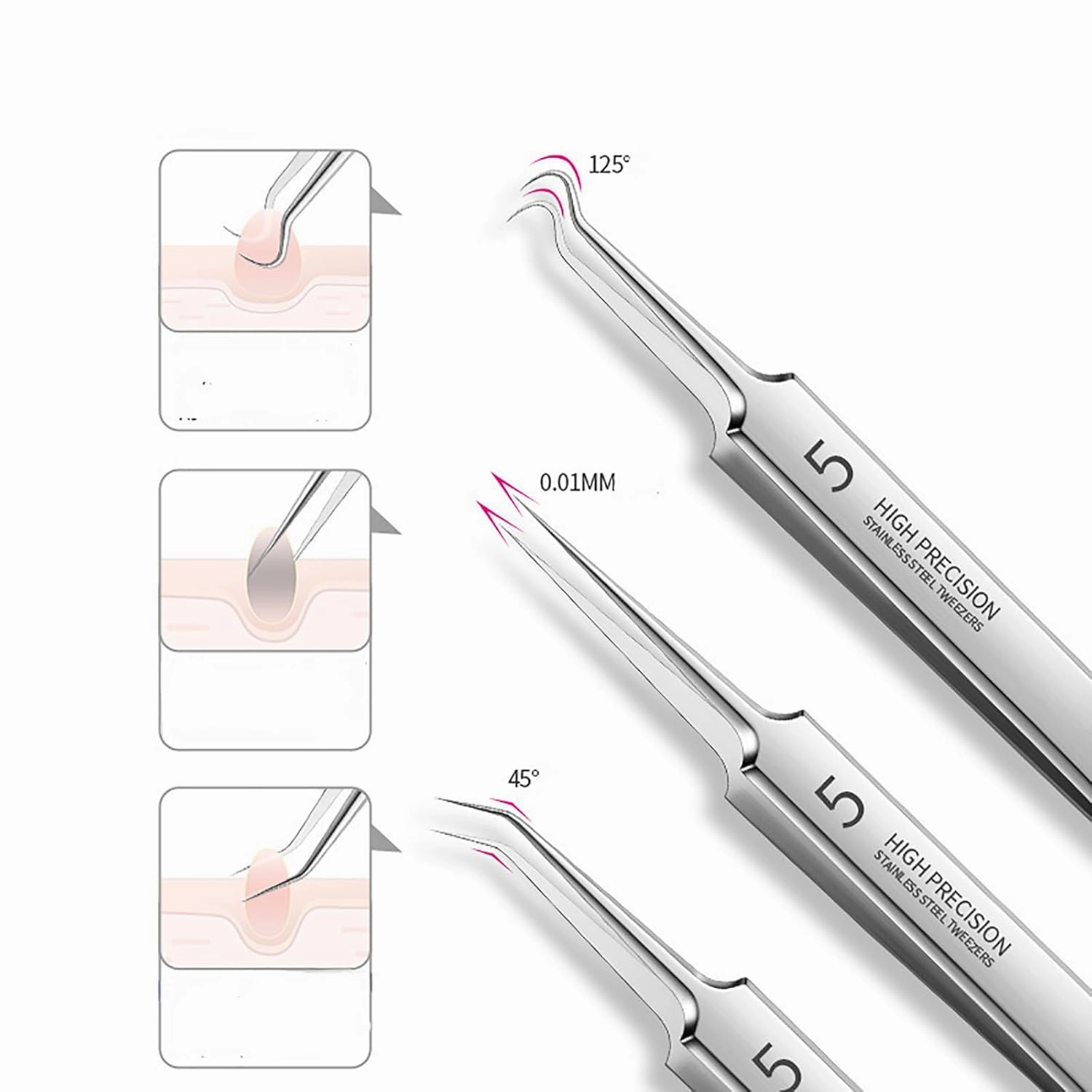 Teppeic Tweezers for Blackheads, Facial Blackhead Remover Tweezers, Precision Pimple Popper Tool Kit for Whitehead Ance Blemishs Comedones Stainless Steel Makeup Tool (3PCS /Set *1)