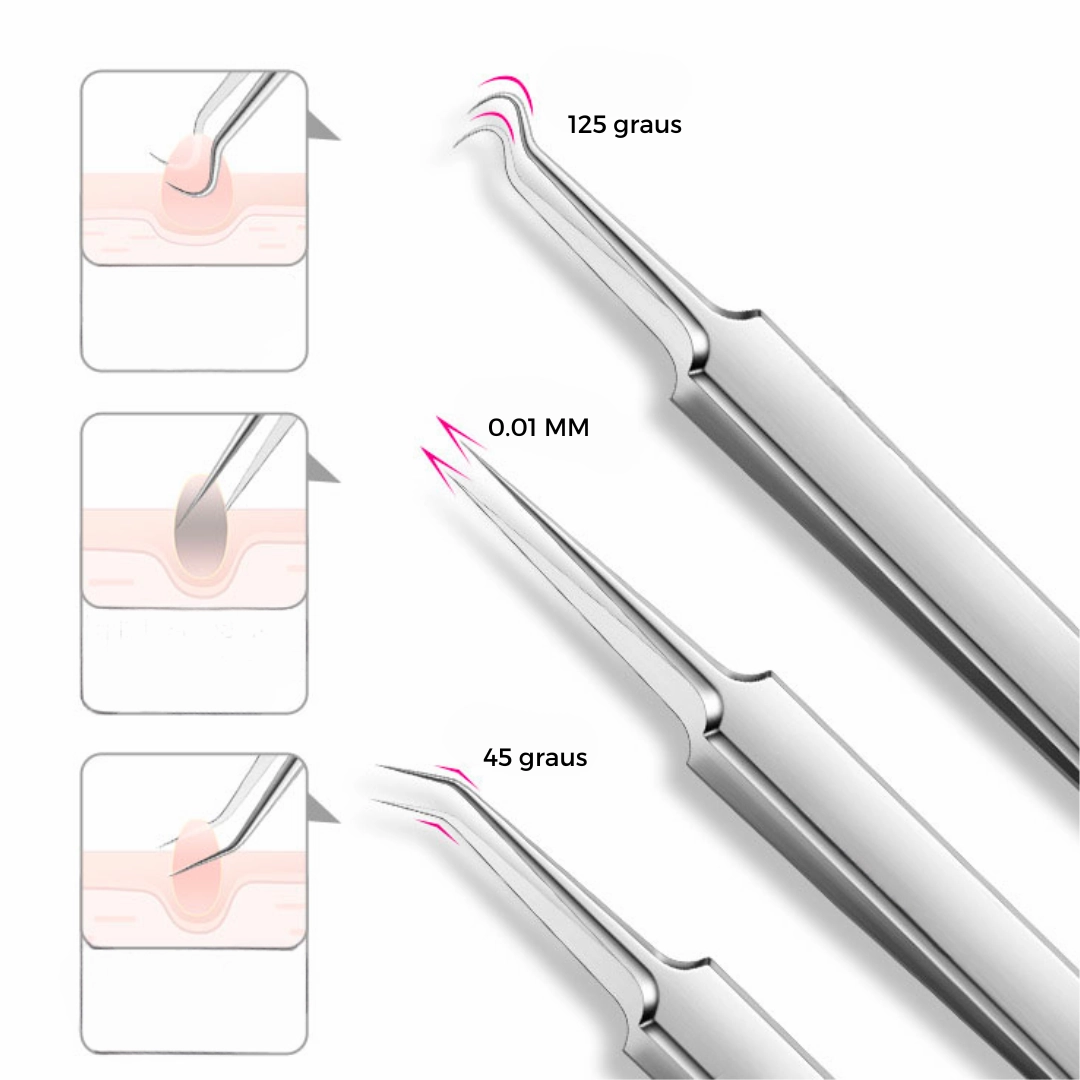 The Tweezers