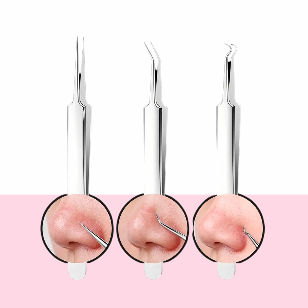 The Tweezers